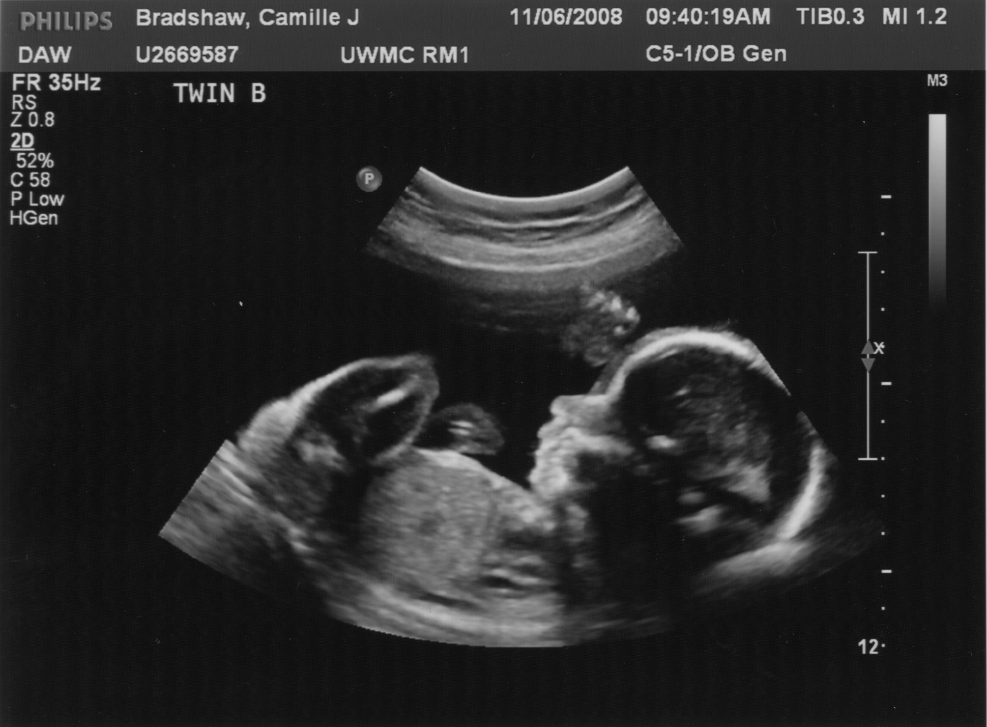 Фото беременности на 22 недели беременности